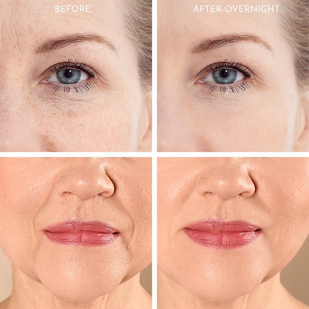 Truly Clear 20X Reusable Expression Line Smoothing, Medical-Grade Silicone for Overnight Wrinkle Reduction & Anti-Aging Hydration, Beautify Brow Lift Forehead Anti-Wrinkle Patch