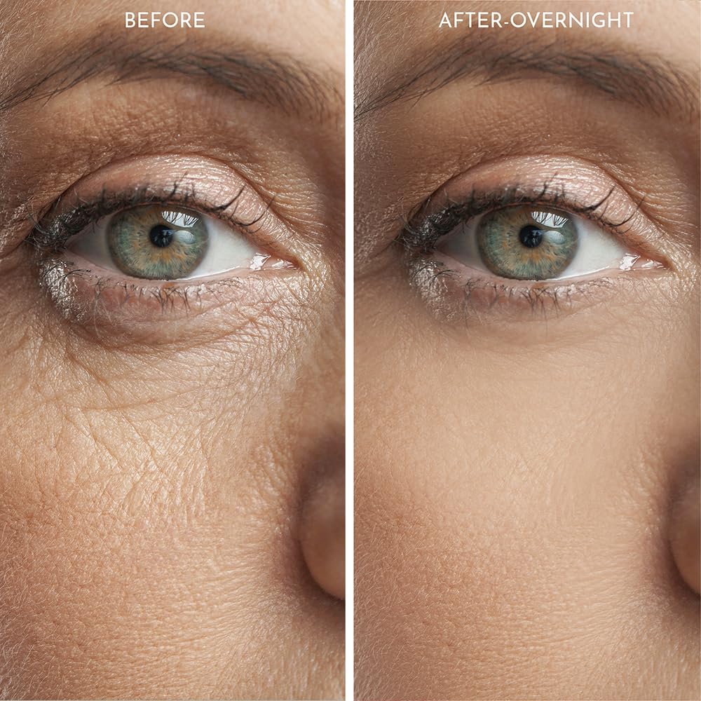 Truly Clear 20X Reusable Expression Line Smoothing, Medical-Grade Silicone for Overnight Wrinkle Reduction & Anti-Aging Hydration, Beautify Brow Lift Forehead Anti-Wrinkle Patch